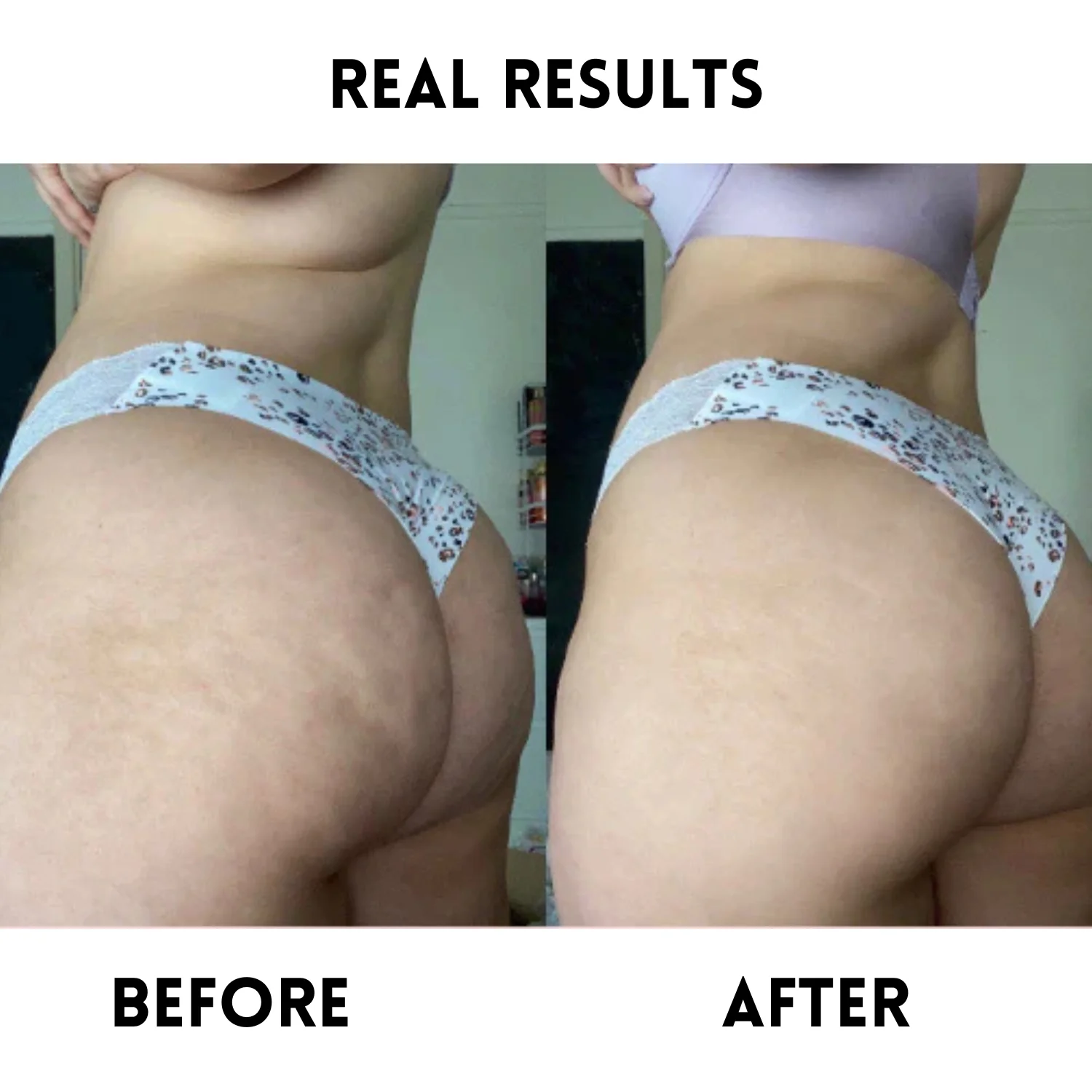 Mortaine Anti-Cellulite Massage Oil