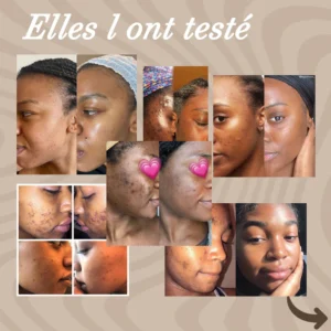 The Best Turmeric Cotton