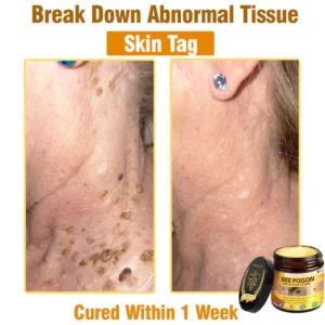 LOVILDS™ Bee Poison All-in-One Cream US Dermatologist Approved