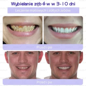 ZVL™ Mineral Tooth Repair Powder