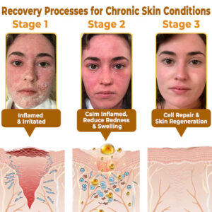 BeeRx™ Natural Relief Cream