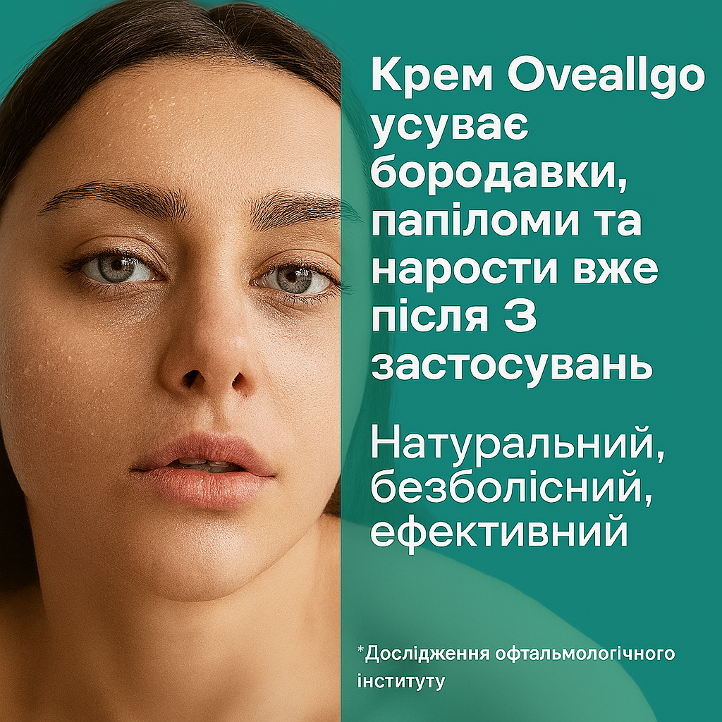 Oveallgo GentX Relief Cream – A universal remedy for skin health