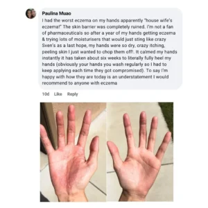 Miracle Manuka - Skin Repair Ointment 100g