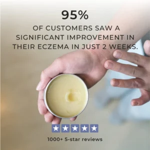 Miracle Manuka - Skin Repair Ointment 100g