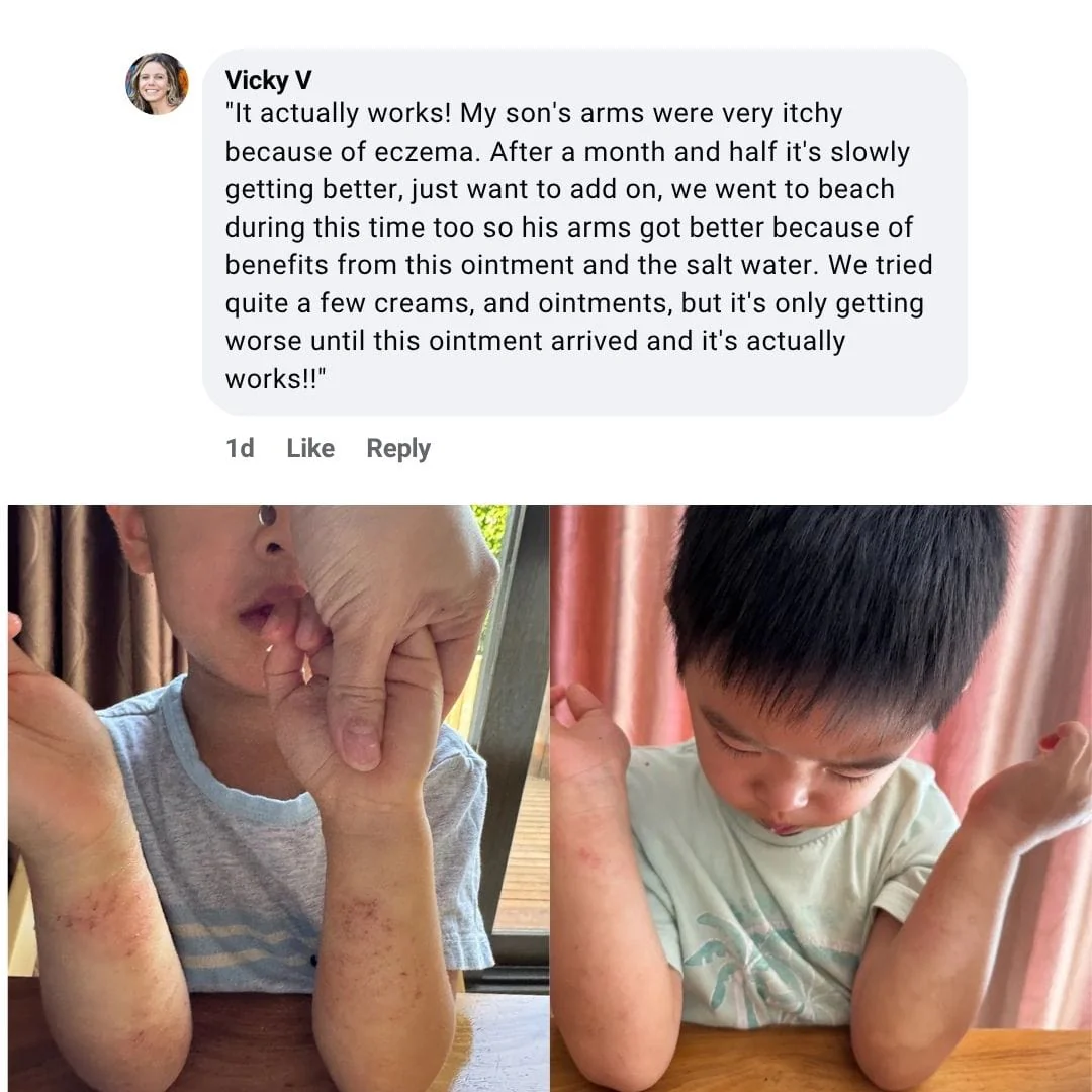 Miracle Manuka - Skin Repair Ointment 100g