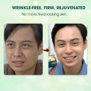 Abera Wrinkle Cream – Erases Wrinkles