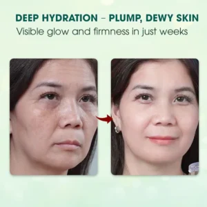 Abera Wrinkle Cream – Erases Wrinkles