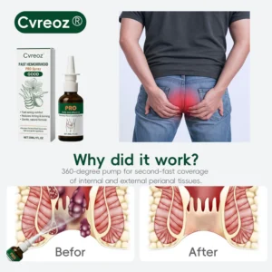 Cvreoz® Fast Hemorrhoid PRO Spray