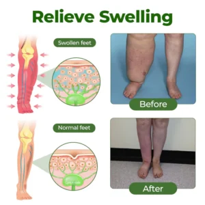 leg comfort cream designed for tired legs