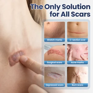 skin resurfacing support gel