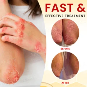 soothing skin comfort product