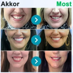 Furzero® Oral hygiene powder with bee venom