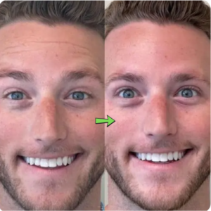 Anti-Aging Firming Cream – Wrinkle & Fine Line Reduction Formula