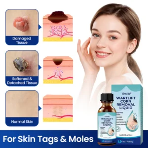 wartlift liquid for everyday skin care routine