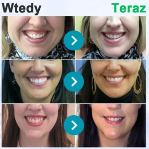 fresh feel daily toothpaste