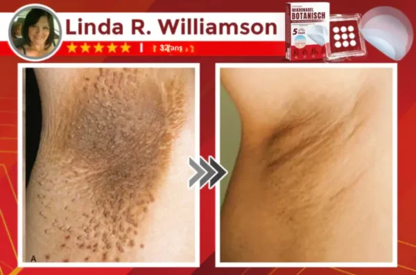 Fivfivgoยฎ MicroNeedle Botanical Skin Tag Patch - Image 15