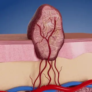 Fivfivgoยฎ MicroNeedle Botanical Skin Tag Patch - Image 10