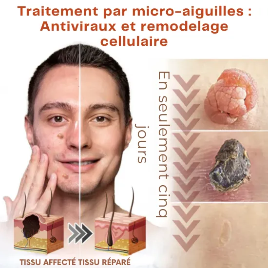 Fivfivgoยฎ MicroNeedle Botanical Skin Tag Patch - Image 13