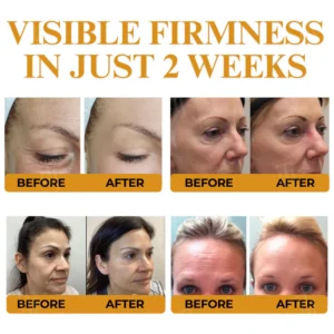 wrinkle smoothing skincare cream