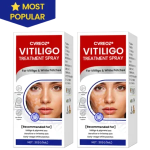 Cvreoz®Vitiligo Treatment Spray