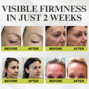 AEXZR® Botox & Vita-A Retinol Shot Wrinkle