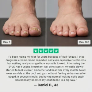 SYLK Nail Fungus Treatment Gel