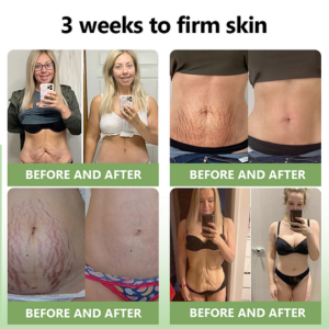 collagen cream designed for everyday skincare