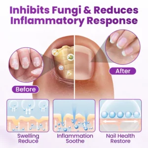 aerosol style foot care spray for convenience