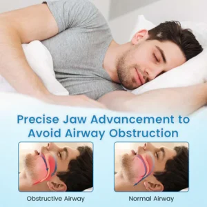 PerfectSleep Solution-Anti-Snoring & Anti-Grinding Teeth Protector
