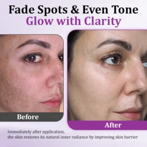 Intensive Hyperpigmentation Treatment Serum