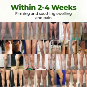 leg relief cream for long standing or sitting