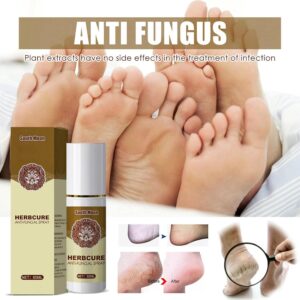 Anti-Fungal Treatment Spray – Fast-Acting Formula for Itching, Odor and Skin Relief