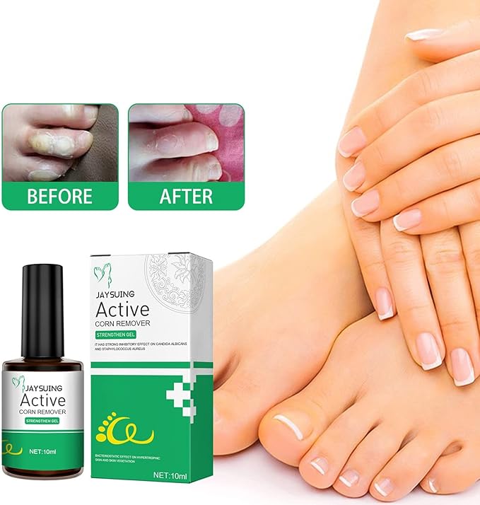 JAYSUING Effective Skin Corns Wart Remover Liquid Serum 1c1e21" face="Roboto, Arial, sans-serif">????কর্ন এবং কলাস হল ত্বকের পুরু, শক্ত স্তর যা ত্বক যখন ঘর্ষণ বা চাপ থেকে নিজেকে রক্ষা করার চেষ্টা করে তখন তৈরি হয়। এগুলি প্রায়শই পা এবং পায়ের আঙ্গুলে বা হাত এবং আঙ্গুলে তৈরি হয়। কর্ন ব্যথাজনক হতে পারে, বিশেষ করে যখন চাপ প্রয়োগ করা হয় এবং আকার এবং চেহারায় ভিন্নতা থাকতে পারে।????