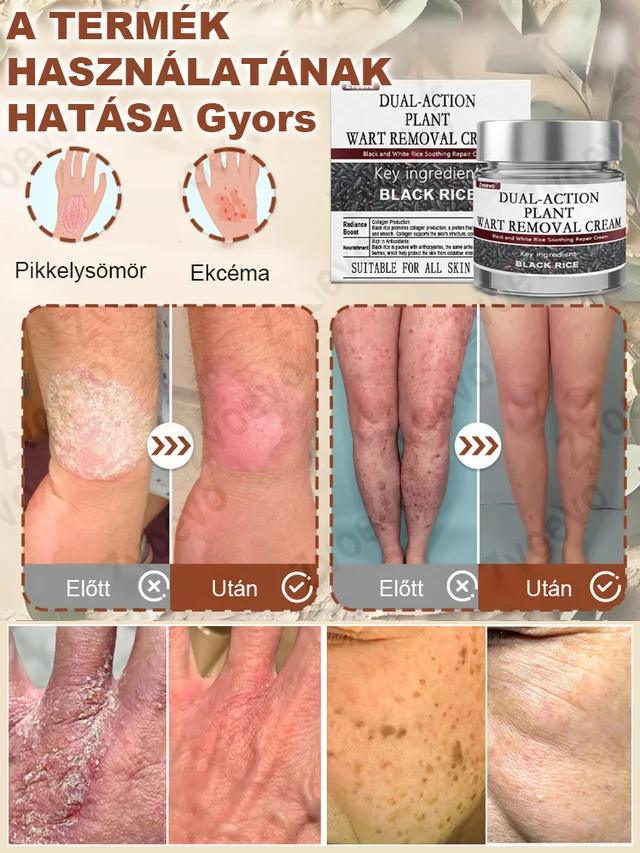 black rice skin regenerating cream