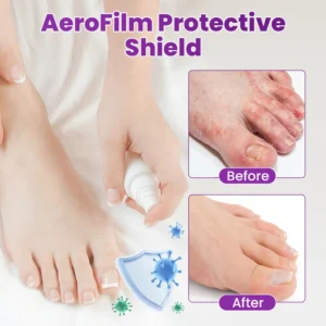 spray solution to support clean and dry feet