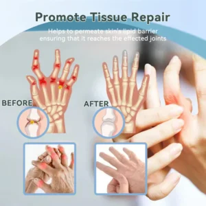 Cvreoz®Nerve Repair &Pain Relief Magnesium Cream