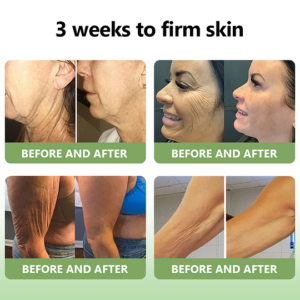 skin elasticity cream with natural ingredients