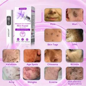non surgical skin repair laser
