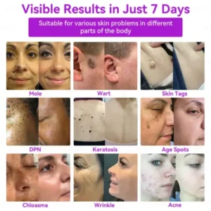 home use skin repair laser pen