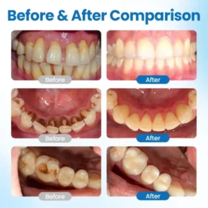 non abrasive enamel care