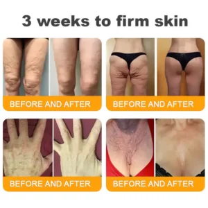 LOVILDS™ Bee Venom Skin Restoration Cream