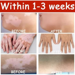 kubozn skin tone support spray