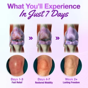 turmeric emu oil joint pain relief gel