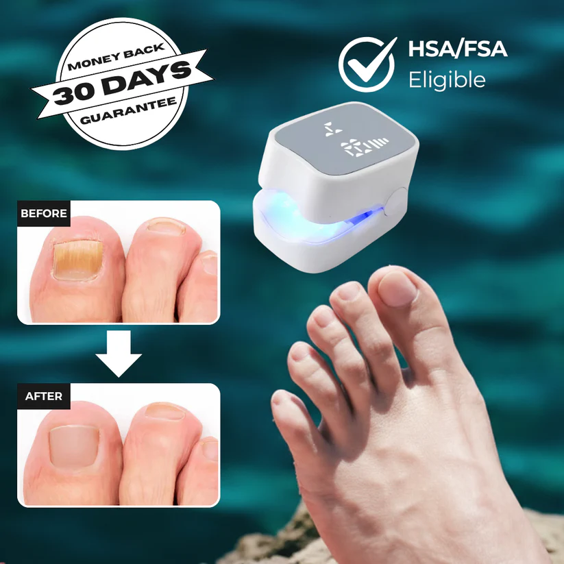 Laser Nail Fungus Treatment Device – Deep Penetration & Fast Repair