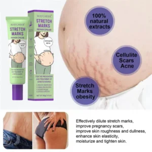 body stretch marks care cream