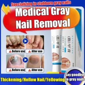 Anti-Fungal Nail Repair Cream – Clear, Healthy & Strong Nails Formula