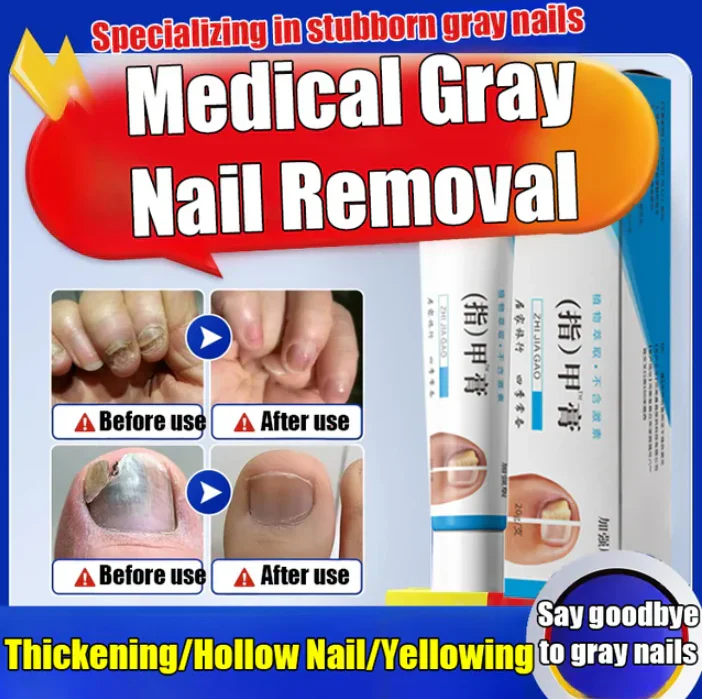 Anti-Fungal Nail Repair Cream – Clear, Healthy & Strong Nails Formula