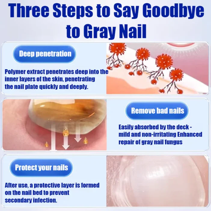 Anti-Fungal Nail Repair Cream – Clear, Healthy & Strong Nails Formula