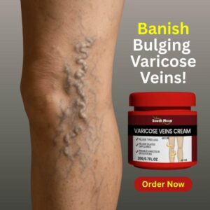 Herbal Varicose Vein Relief Cream – Circulation & Leg Comfort Formula