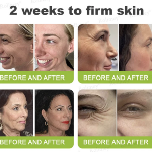 Rolimey® Botox & Vita-A Retinol Firming & Anti-Wrinkle Serum